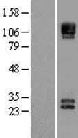 NCAM / CD56 Protein (Over-Expression Lysate Myc-DDK (Flag))