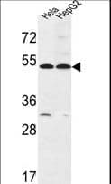 IHC-plus™ Polyclonal Rabbit anti-Human FERMT1 / Kindlin Antibody (aa268-297, IHC, WB)