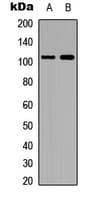 HDAC7 Antibody (N-Terminus)
