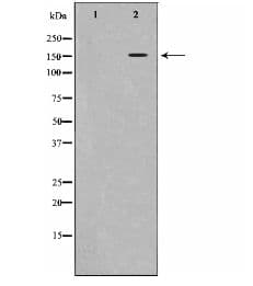 Polyclonal Rabbit anti-Human KDR / VEGFR2 / FLK1 Antibody (phospho-Tyr1214, IHC, WB)