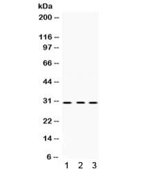 PRKAB2 / AMPK Beta 2 Antibody