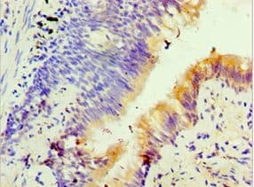 FOSL2 / FRA-2 Antibody (aa187-326)
