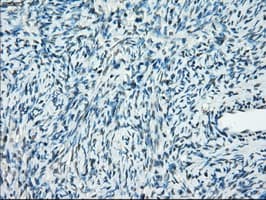 PPP5C Antibody (clone OTI2E12)