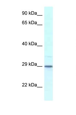 KCNIP3 / Dream / Calsenilin Antibody (aa30-79)