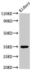 Polyclonal Rabbit anti-Human YIF1B Antibody (aa1-153)