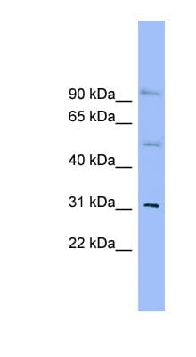 SLC25A25 Antibody (N-Terminus)