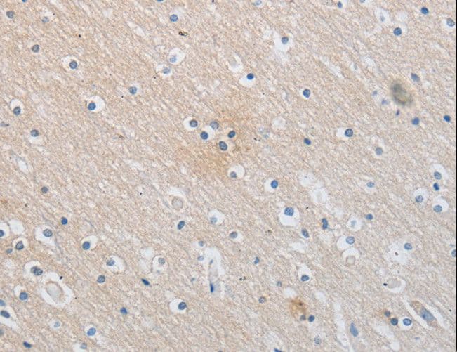 SLC16A7 / MCT2 Antibody