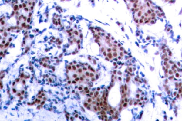 JUN / c-Jun Antibody (phospho-Ser73)