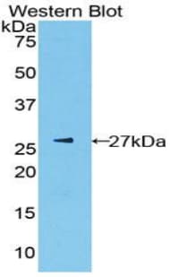 PKLR Antibody (aa114-323)