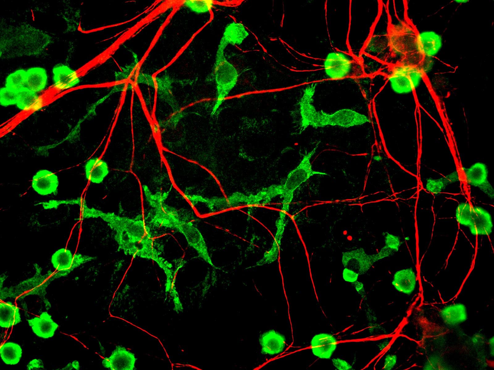 IHC-plus™ Polyclonal Chicken anti-Human INA / Alpha Internexin Antibody (IHC, IF, WB)
