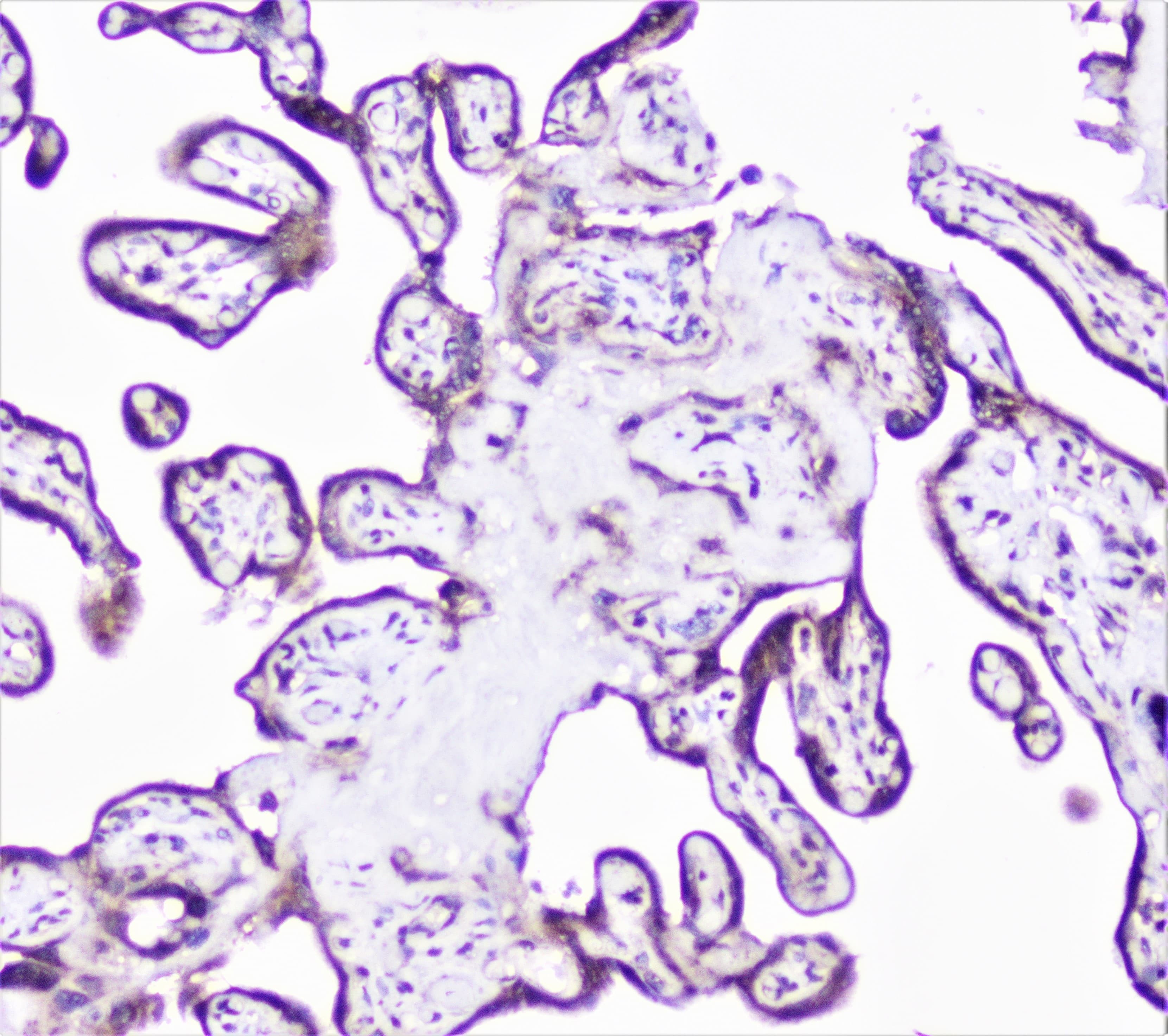 CTTN / Cortactin Antibody