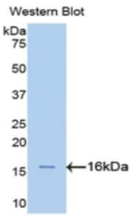 SPTAN1 / Alpha Fodrin Antibody (aa289-408)
