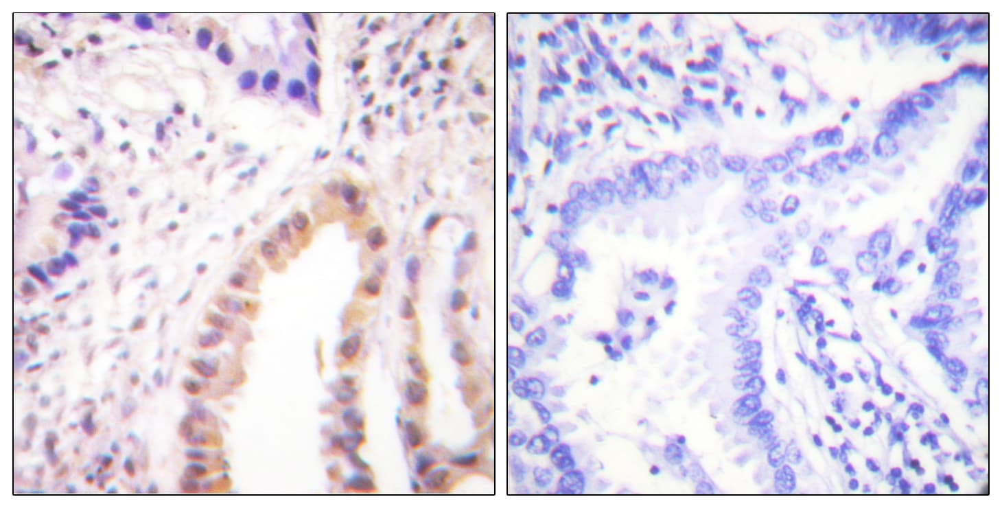 MEF2D Antibody (phospho-Ser444)