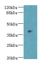 DLK2 Antibody