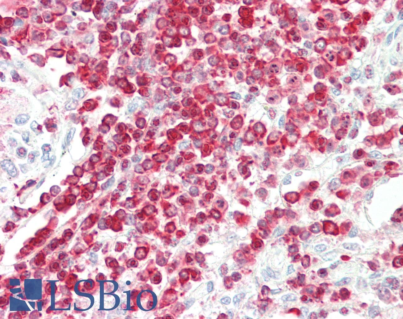 IHC-plus™ CORO1A / Coronin 1a Antibody