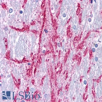PathPlus™ GRM4 / MGLUR4 Antibody (N-Terminus)