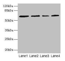 Polyclonal Rabbit anti-Human CSGALNACT2 Antibody (IHC, WB)