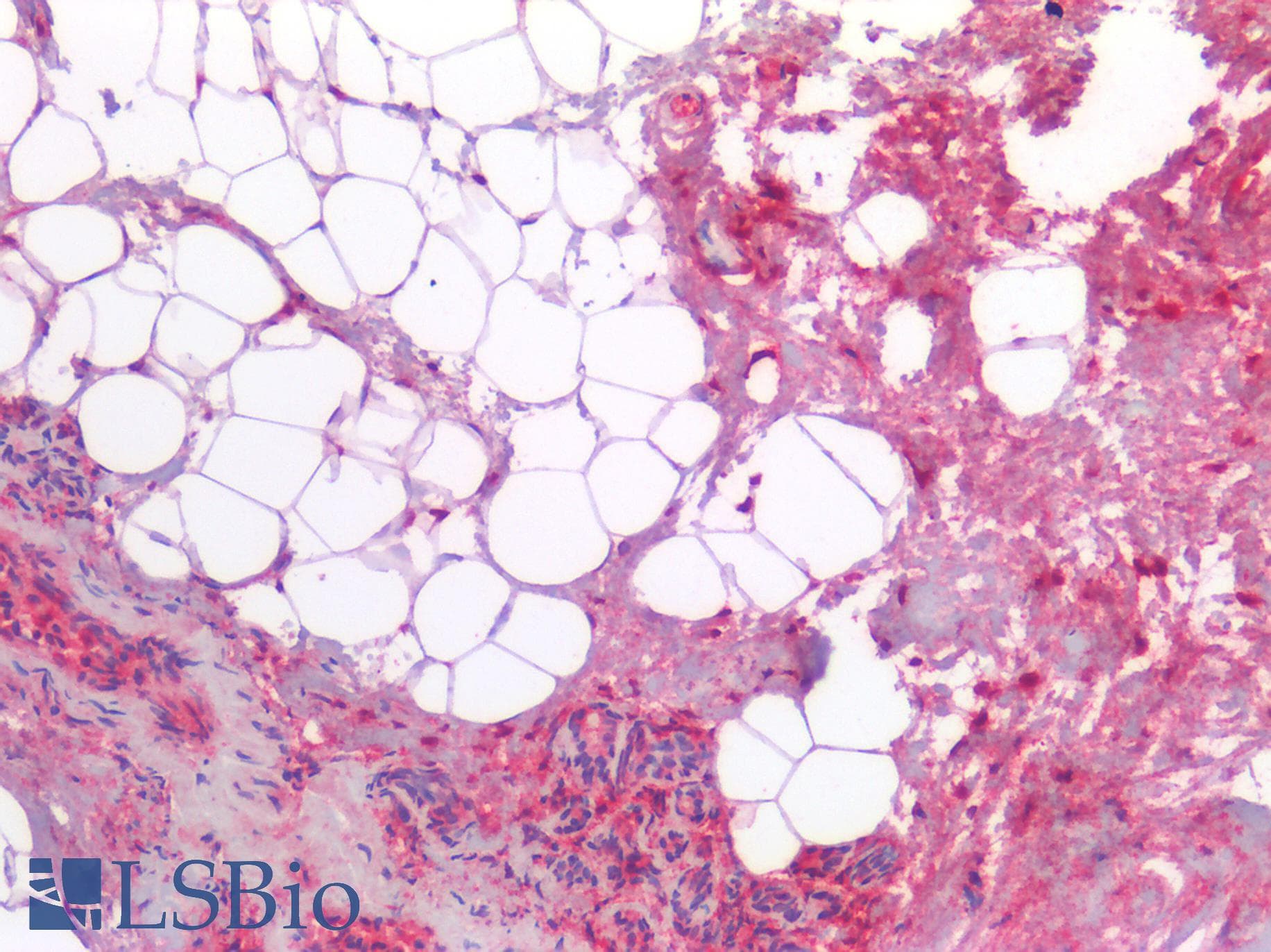 COL3A1 / Collagen III Antibody