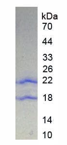 Human PTPRN / IA-2 Protein (Recombinant His)