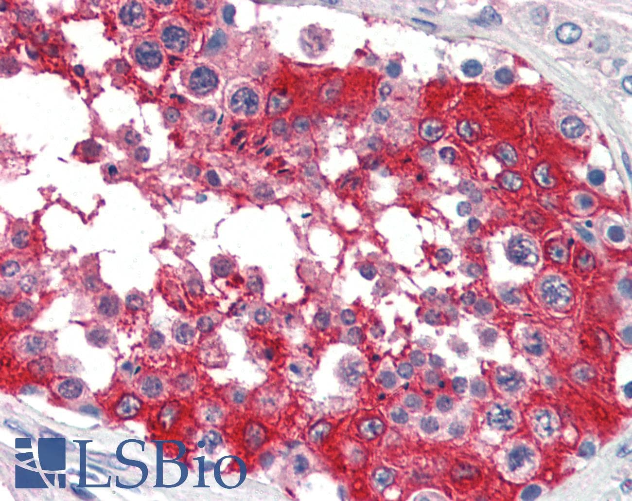 IHC-plus™ Polyclonal Goat anti-Human G6PD Antibody (aa305-318, IHC, WB)