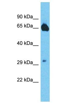 MTSS1L Antibody (aa113-162)