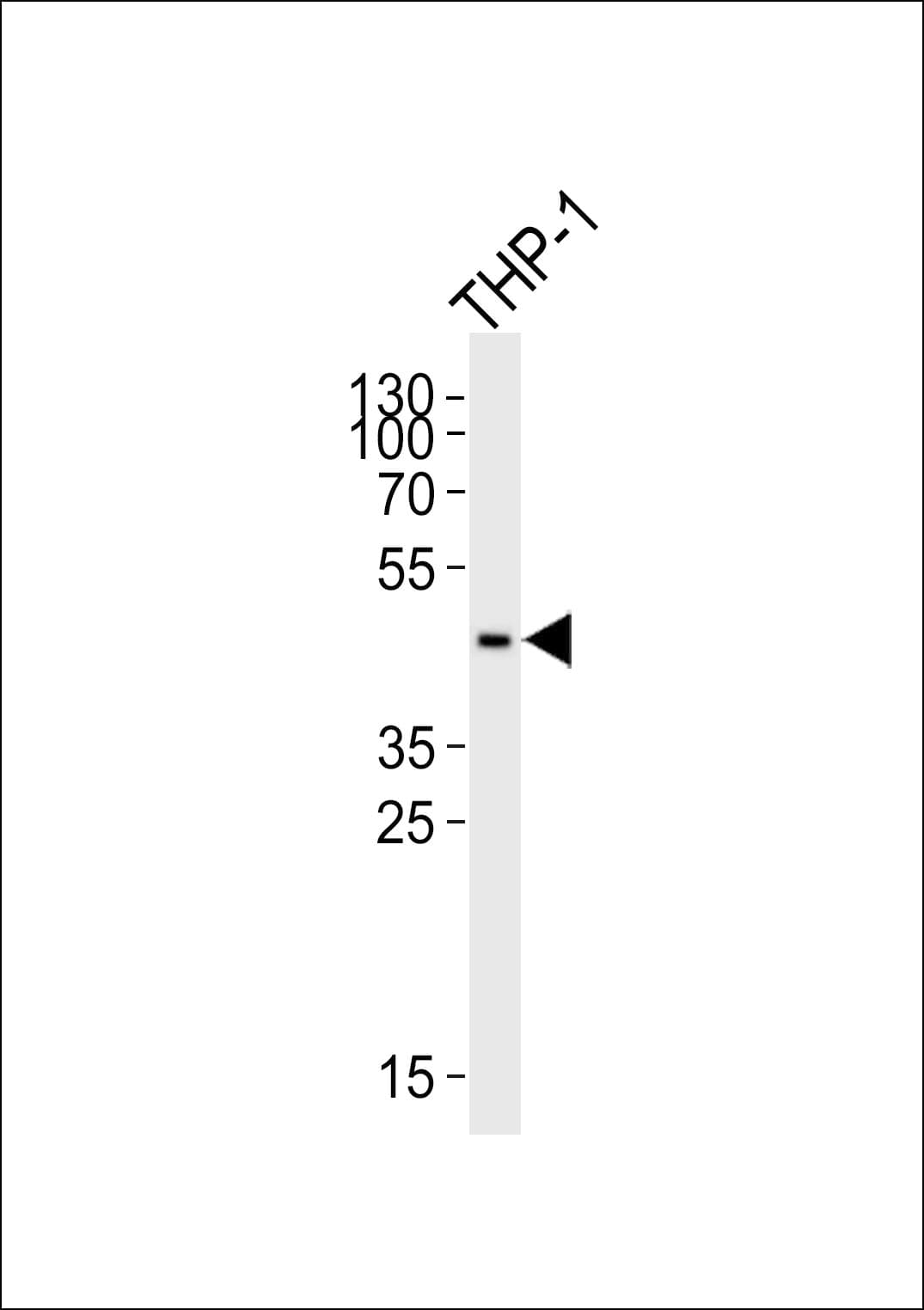 CCR2 Antibody (aa336-369)