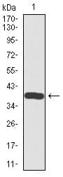 SST / Somatostatin Antibody (clone 7G5)