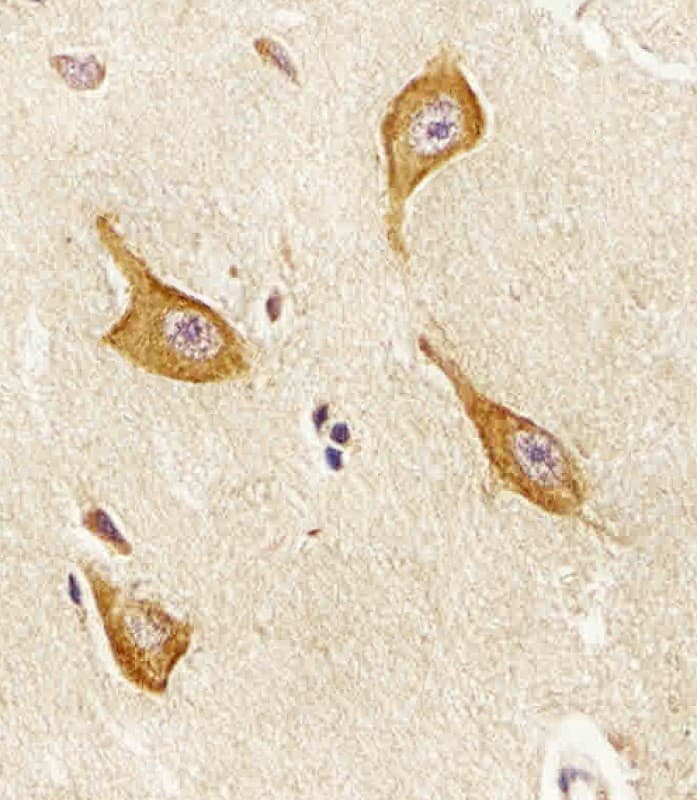 PIP4K2A / PIPK Antibody (aa329-363)