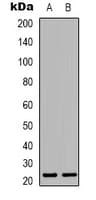 MRPL22 Antibody (Internal)
