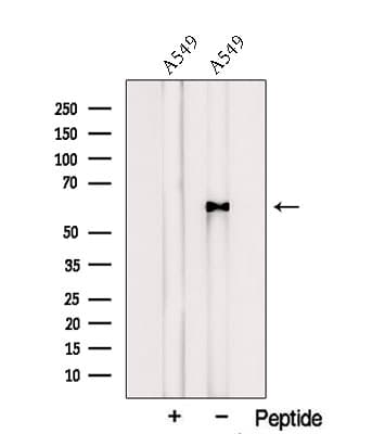 Polyclonal Rabbit anti-Human PSMC1 Antibody (WB)