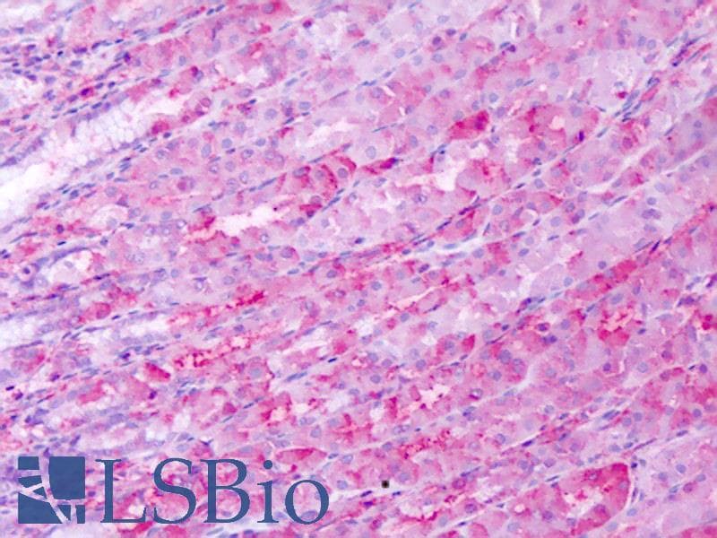 IHC-plus™ Polyclonal Rabbit anti-Human BEST4 Antibody (Internal, IHC)