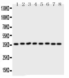 ANXA5 / Annexin V Antibody (aa2-320)