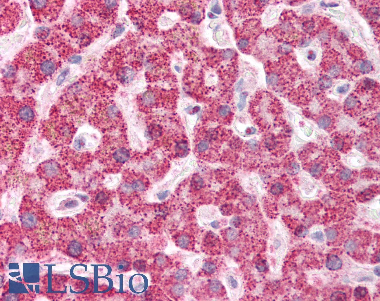IHC-plus™ IFIH1 / MDA5 Antibody