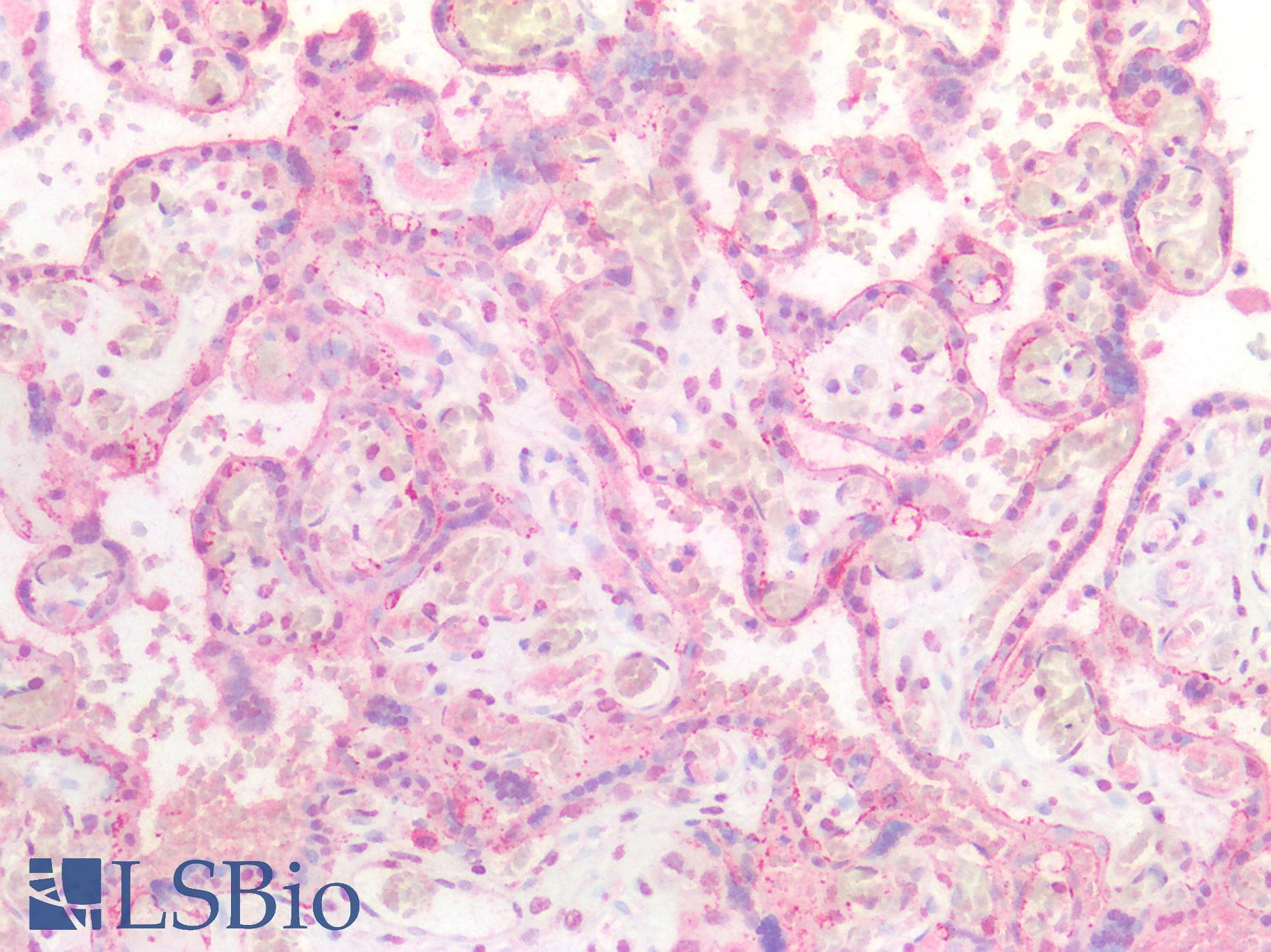 IHC-plus™ Polyclonal Rabbit anti-Human EBI3 / IL-27B Antibody (IHC)