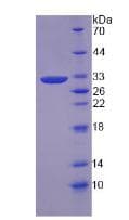 Human VWA2 Protein (Recombinant His, N-Terminal)