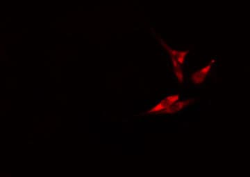 Polyclonal Rabbit anti-Human TNFSF11 / RANKL / TRANCE Antibody (IHC, IF, WB)
