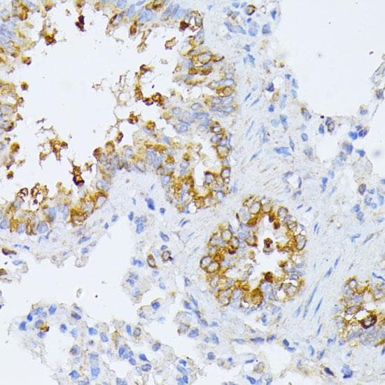 Polyclonal Rabbit anti-Human EIF2B2 Antibody (IHC, IF)