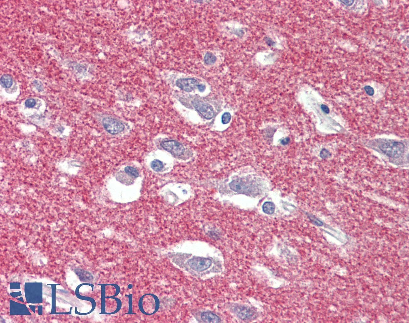 IHC-plus™ Polyclonal Goat anti-Human AP2A1 / AP2-Alpha Antibody (aa706-727, IHC, WB)