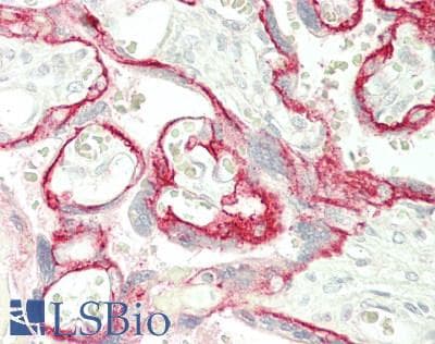 IHC-plus™ SLC16A1 / MCT1 Antibody