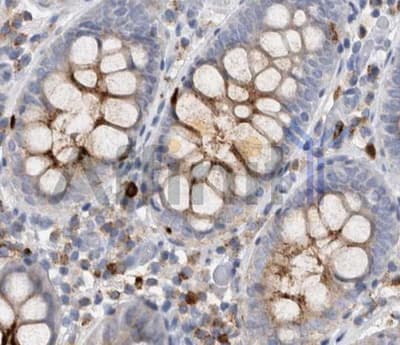 Polyclonal Rabbit anti-Human CD63 Antibody (IHC, WB)