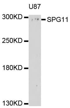 KIAA1840 / SPG11 Antibody