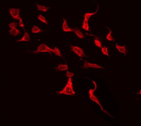 KCNJ5 / Kir3.4 / GIRK4 Antibody
