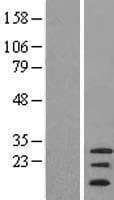 C20orf141 Protein (Over-Expression Lysate Myc-DDK (Flag))