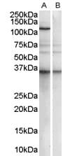 IHC-plus™ PUM2 Antibody (aa141-155)