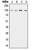 CSF2RB / CD131 Antibody (C-Terminus)