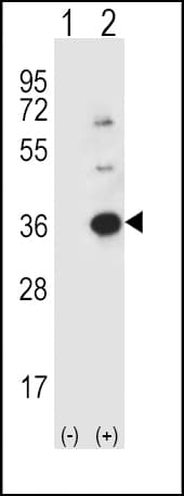 Polyclonal Rabbit anti-Human CASP3 / Caspase 3 Antibody (aa60-90, IHC, WB)