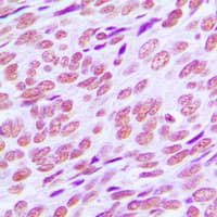 CCNE1 / Cyclin E1 Antibody (C-Terminus)