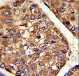 PDI / P4HB Antibody (aa436-464)