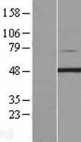 Human PIP4K2C Protein (Over-Expression Lysate Myc-DDK (Flag))