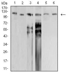 Monoclonal Mouse anti-Human SMARCA1 / SWI Antibody (clone 2H7B9, IHC, WB)